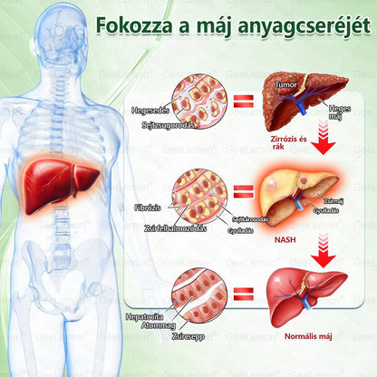 Ajánlott a Semmelweis Kórház által · 👩‍⚕️BENU hivatalos üzlet| 🎁 𝐆𝐞𝑒𝐿𝑒𝐦𝐨𝐧® Glumasetide 8 az 1-ben Karcsú és Egészséges Nano Mikrotűs Tapasz🇭🇺