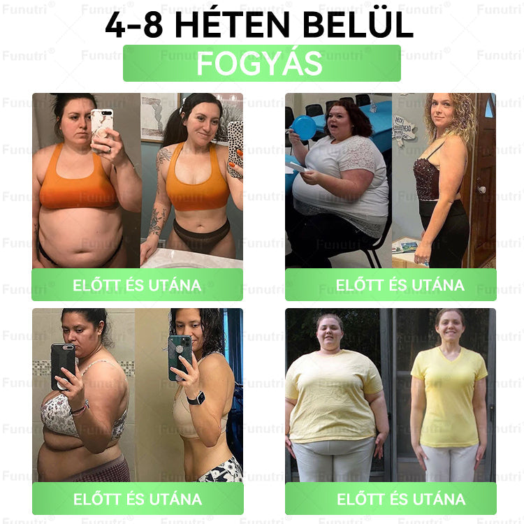 Magyar szakértők által ajánlott 💖Funutri® 10 az 1-ben anyagcsere-támogató karcsúsító nano mikro-tűs tapasz