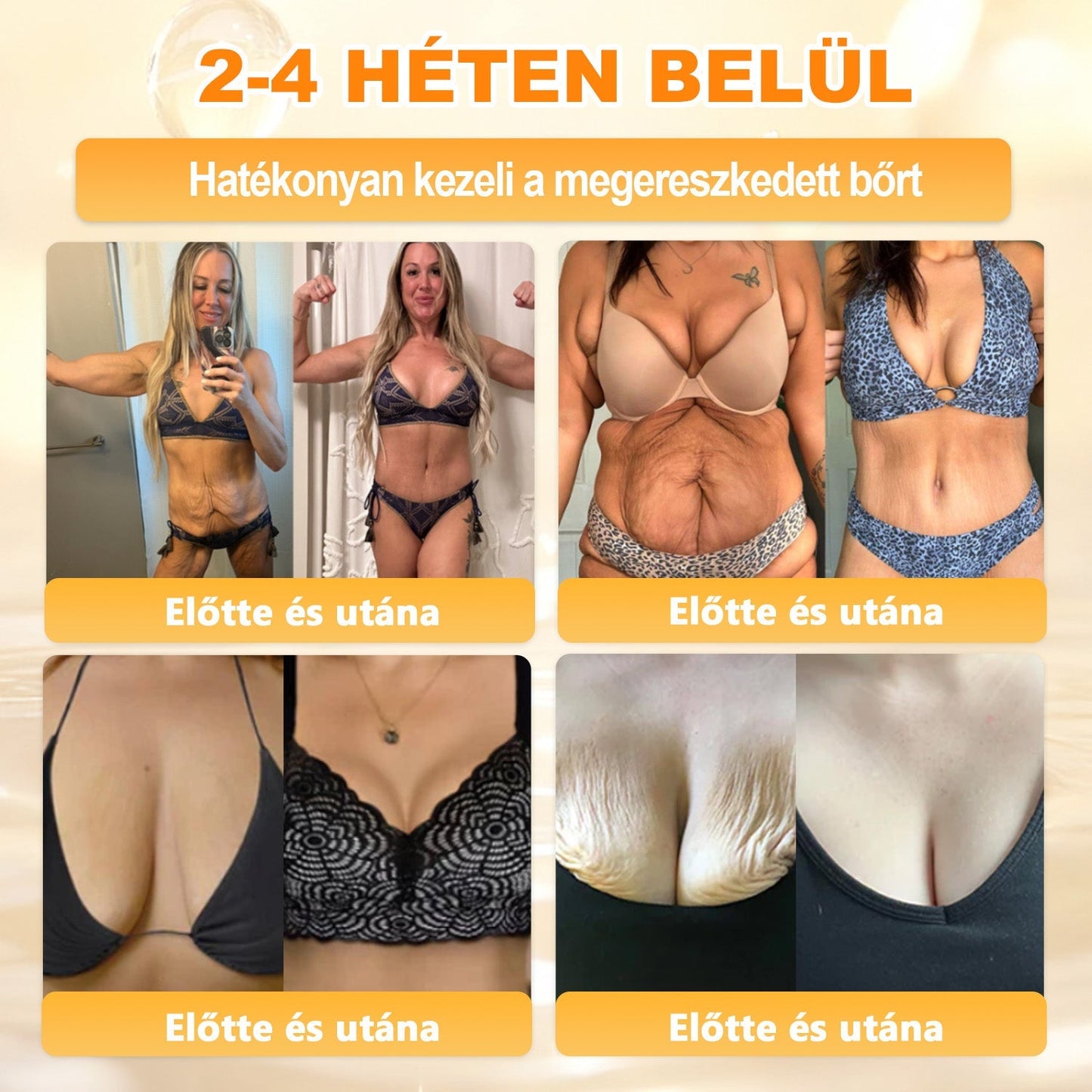 ✨✨ 𝐀𝐏𝐊𝐀𝐏𝐊® Természetes Méhméreges Arckrém – gondosan összeállított formula a bőr táplálására, hidratálására és regeneráló ápolására ✨