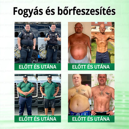 Ajánlott a Semmelweis Kórház által · 👩‍⚕️BENU hivatalos üzlet| 🎁 𝐆𝐞𝑒𝐿𝑒𝐦𝐨𝐧® Glumasetide 8 az 1-ben Karcsú és Egészséges Nano Mikrotűs Tapasz🇭🇺