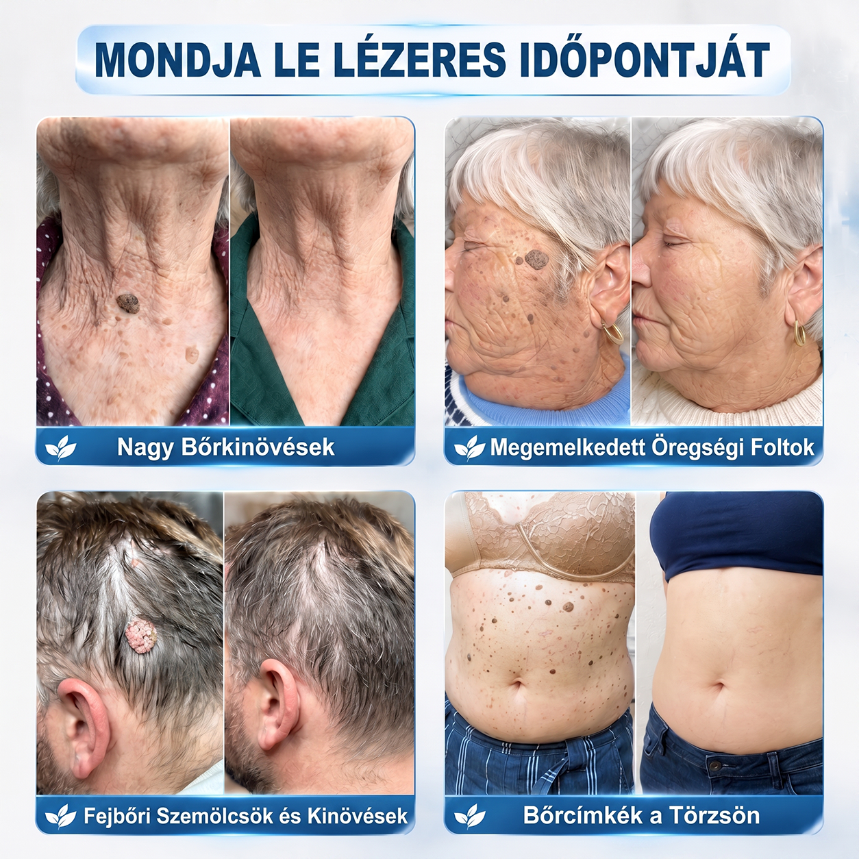 🎁 Már csak 5 doboz maradt! Most további 30% kedvezményt adunk! Legyél fitt és egészséges. Ha most nem élsz a lehetőséggel, legközelebb csak jövőre lesz rá esélyed!