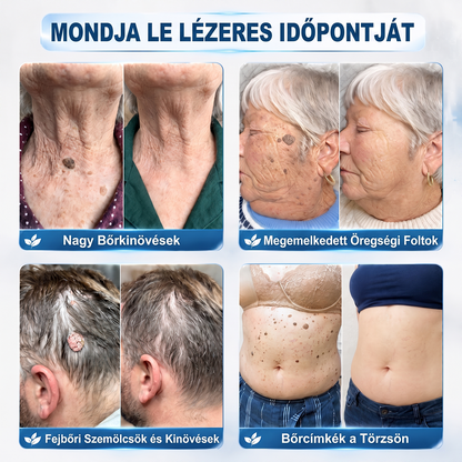 🎁 Már csak 5 doboz maradt! Most további 30% kedvezményt adunk! Legyél fitt és egészséges. Ha most nem élsz a lehetőséggel, legközelebb csak jövőre lesz rá esélyed!