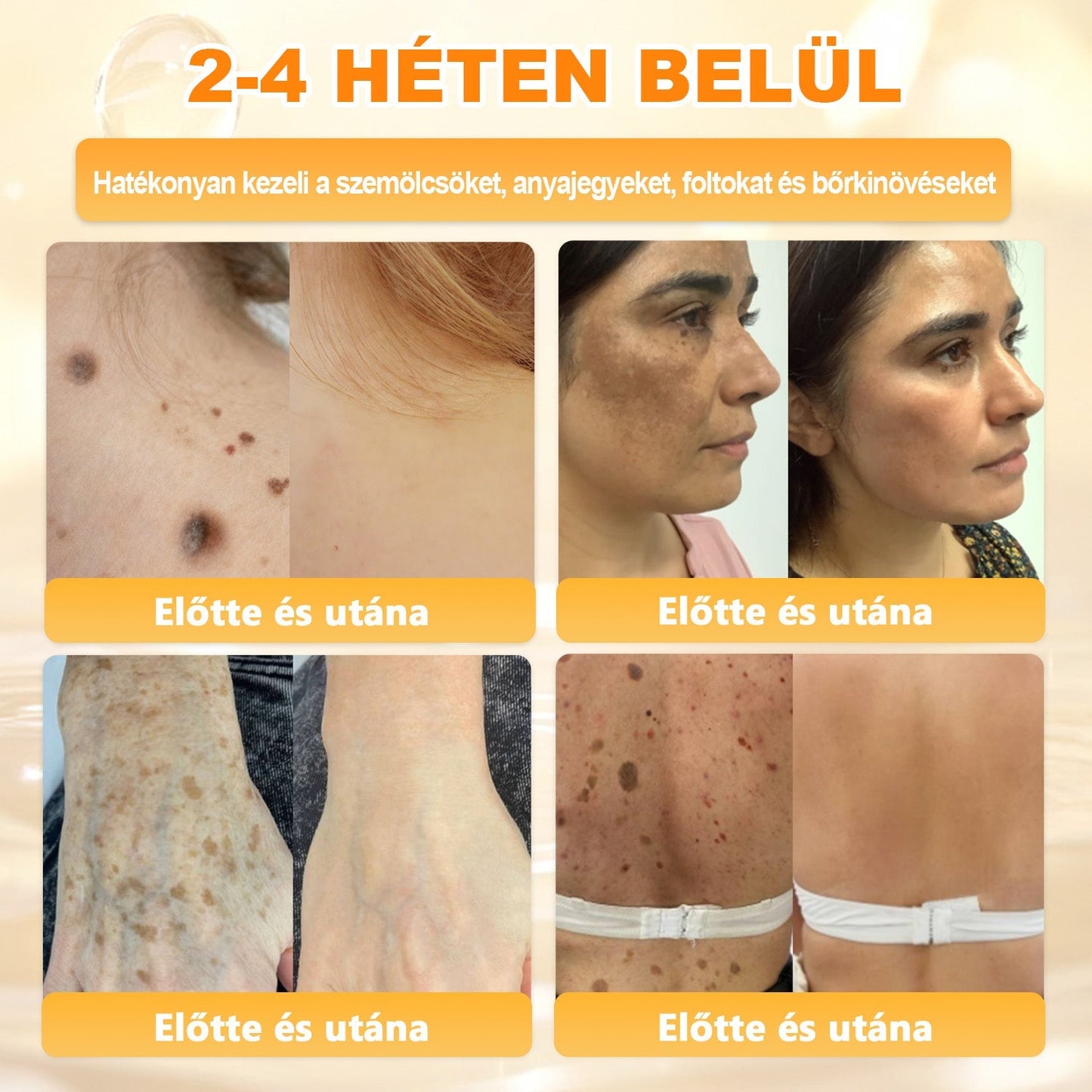✨✨ 𝐀𝐏𝐊𝐀𝐏𝐊® Természetes Méhméreges Arckrém – gondosan összeállított formula a bőr táplálására, hidratálására és regeneráló ápolására ✨