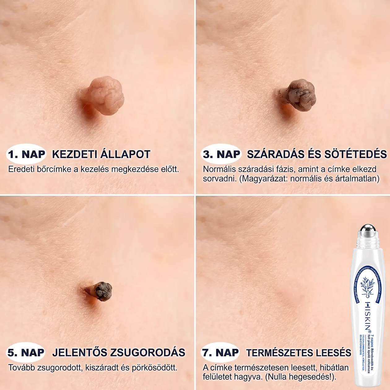 🎁 Már csak 5 doboz maradt! Most további 30% kedvezményt adunk! Legyél fitt és egészséges. Ha most nem élsz a lehetőséggel, legközelebb csak jövőre lesz rá esélyed!