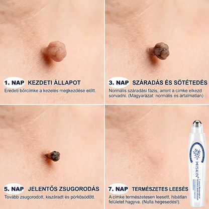 🎁 Már csak 5 doboz maradt! Most további 30% kedvezményt adunk! Legyél fitt és egészséges. Ha most nem élsz a lehetőséggel, legközelebb csak jövőre lesz rá esélyed!