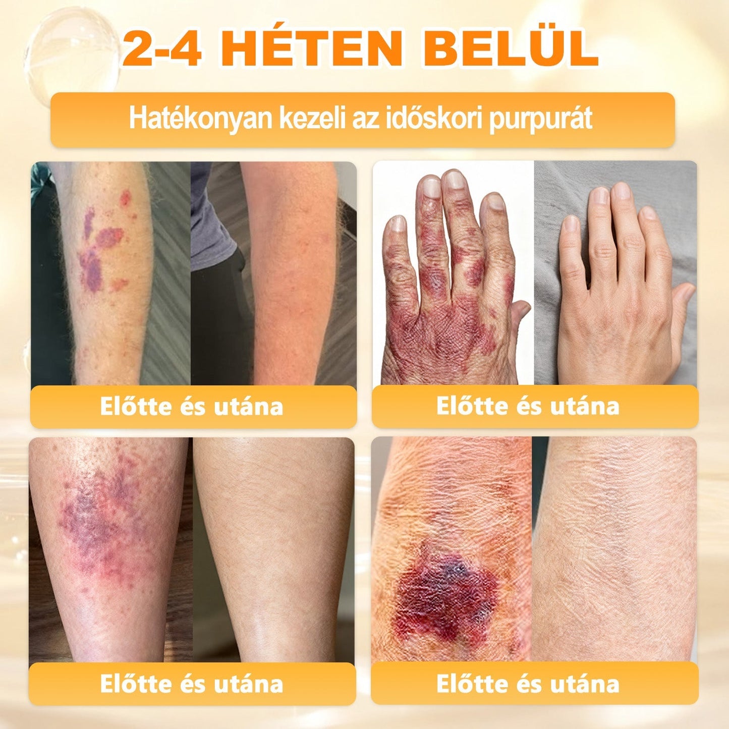 ✨✨ 𝐀𝐏𝐊𝐀𝐏𝐊® Természetes Méhméreges Arckrém – gondosan összeállított formula a bőr táplálására, hidratálására és regeneráló ápolására ✨