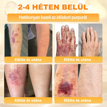 ✨✨ 𝐀𝐏𝐊𝐀𝐏𝐊® Természetes Méhméreges Arckrém – gondosan összeállított formula a bőr táplálására, hidratálására és regeneráló ápolására ✨