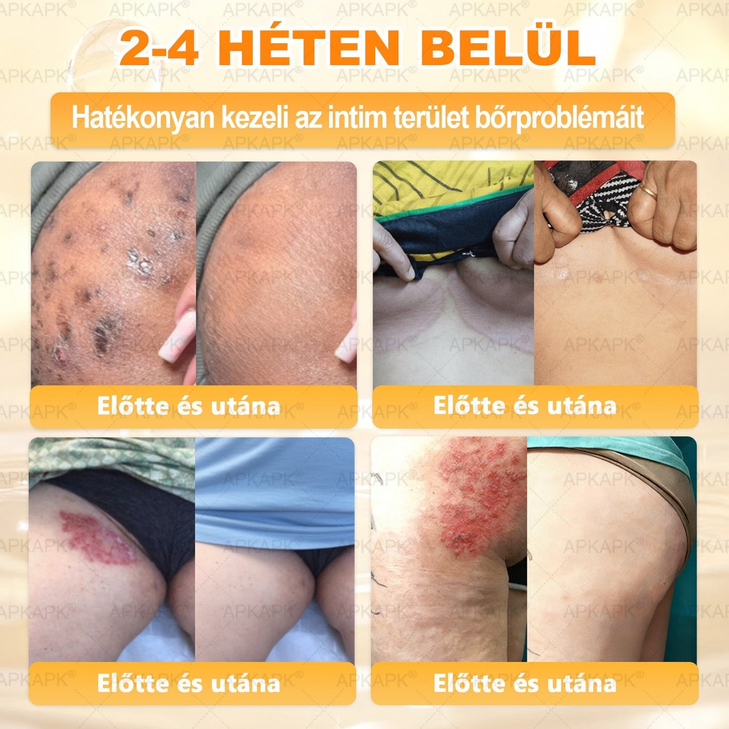 ✨✨ 𝐀𝐏𝐊𝐀𝐏𝐊® Természetes Méhméreges Arckrém – gondosan összeállított formula a bőr táplálására, hidratálására és regeneráló ápolására ✨