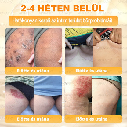 ✨✨ 𝐀𝐏𝐊𝐀𝐏𝐊® Természetes Méhméreges Arckrém – gondosan összeállított formula a bőr táplálására, hidratálására és regeneráló ápolására ✨