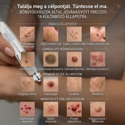 🎁 Már csak 5 doboz maradt! Most további 30% kedvezményt adunk! Legyél fitt és egészséges. Ha most nem élsz a lehetőséggel, legközelebb csak jövőre lesz rá esélyed!