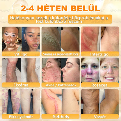 ✨✨ 𝐀𝐏𝐊𝐀𝐏𝐊® Természetes Méhméreges Arckrém – gondosan összeállított formula a bőr táplálására, hidratálására és regeneráló ápolására ✨