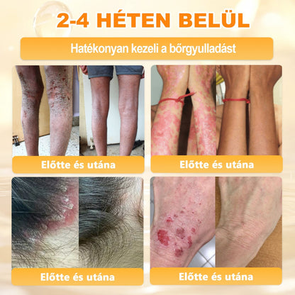 ✨✨ 𝐀𝐏𝐊𝐀𝐏𝐊® Természetes Méhméreges Arckrém – gondosan összeállított formula a bőr táplálására, hidratálására és regeneráló ápolására ✨