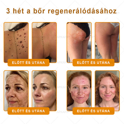 ✨✨ 𝐀𝐏𝐊𝐀𝐏𝐊® Természetes Méhméreges Arckrém – gondosan összeállított formula a bőr táplálására, hidratálására és regeneráló ápolására ✨