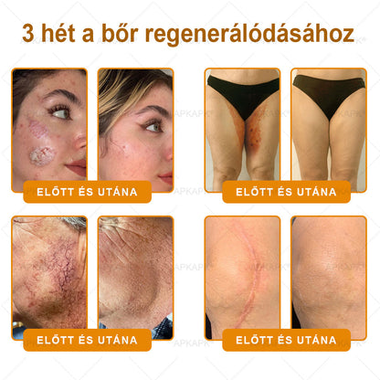 ✨✨ 𝐀𝐏𝐊𝐀𝐏𝐊® Természetes Méhméreges Arckrém – gondosan összeállított formula a bőr táplálására, hidratálására és regeneráló ápolására ✨