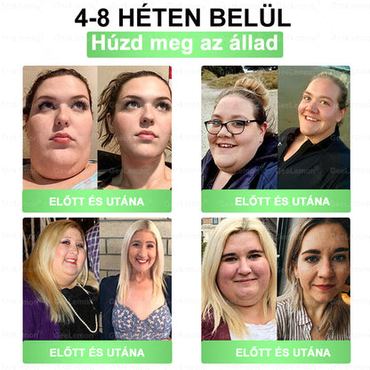 Ajánlott a Semmelweis Kórház által · 👩‍⚕️BENU hivatalos üzlet| 🎁 𝐆𝐞𝑒𝐿𝑒𝐦𝐨𝐧® Glumasetide 8 az 1-ben Karcsú és Egészséges Nano Mikrotűs Tapasz🇭🇺